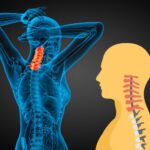 Different Types of Cervical Pain and Diseases, with Their Treatment in Delhi