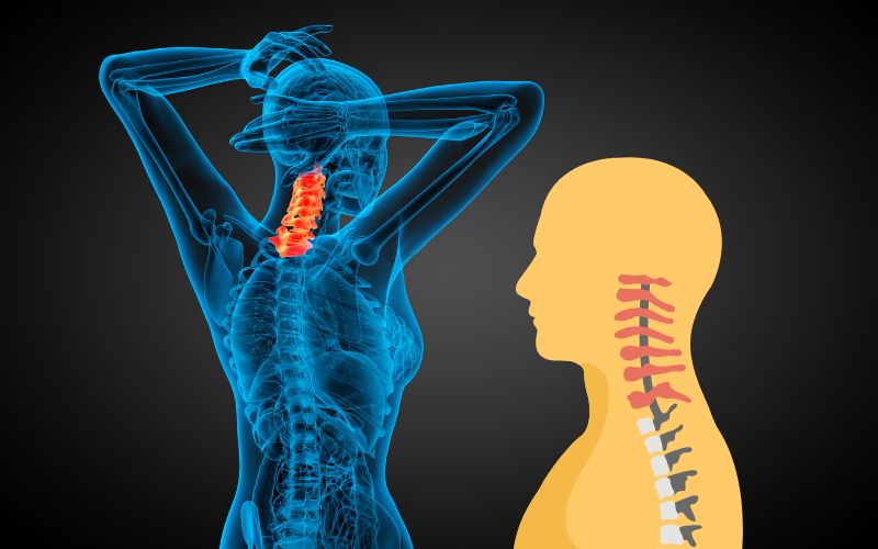 Different Types of Cervical Pain and Diseases, with Their Treatment in Delhi