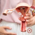 Surgery for Uterus Removal and Its Side Effects