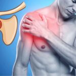 Best Physiotherapy exercises for Shoulder pain in west Delhi