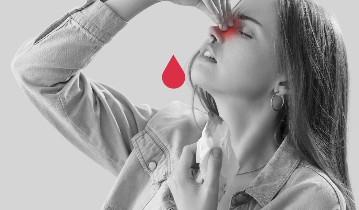 nose bleed treatment in delhi vikaspuri