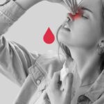 nose bleed treatment in delhi vikaspuri